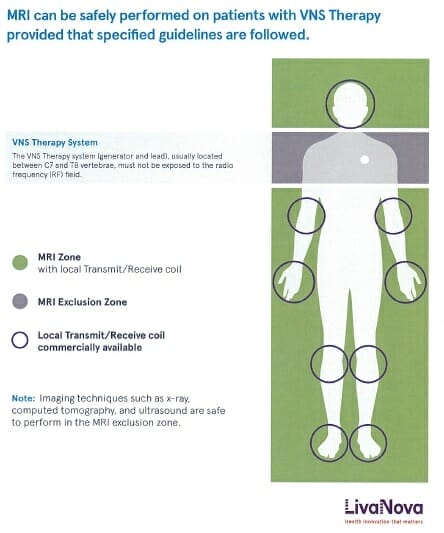 E-360 Edition 24: Questions and Answers 2 Question graphic